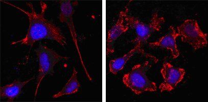 beta-Actin Antibody