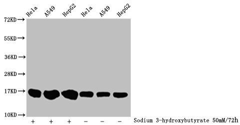 β-hydroxybutyryl-HIST1H3A (K18) Antibody