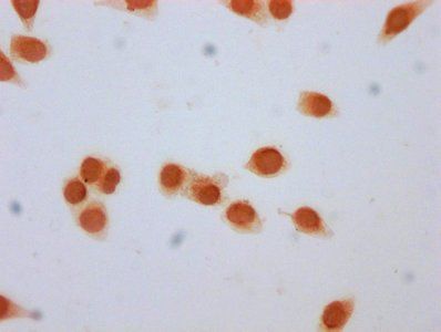 β-hydroxybutyryl-HIST1H3A (K79) Antibody