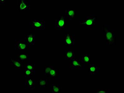 β-hydroxybutyryl-HIST1H3A (K79) Antibody