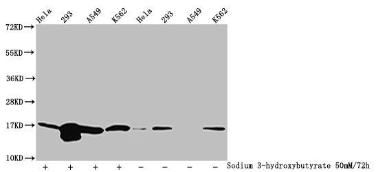 β-hydroxybutyryl-HIST1H3A (K79) Antibody