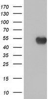beta IV Tubulin Antibody