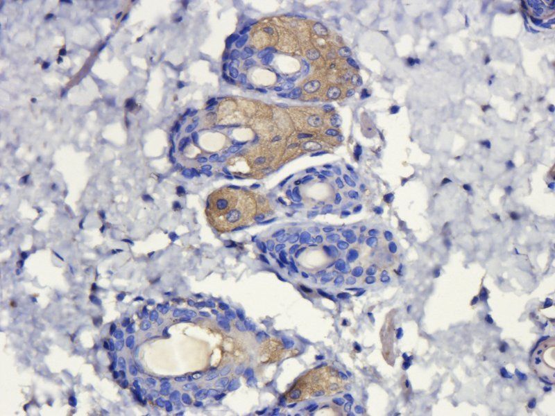 alpha MSH antibody