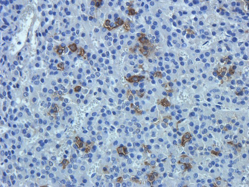 beta Endorphin antibody