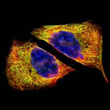 beta IV Tubulin Rabbit Polyclonal Antibody