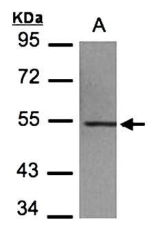 beta IV Tubulin Rabbit Polyclonal Antibody