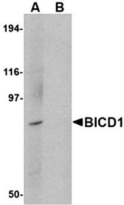 BICD1 Antibody