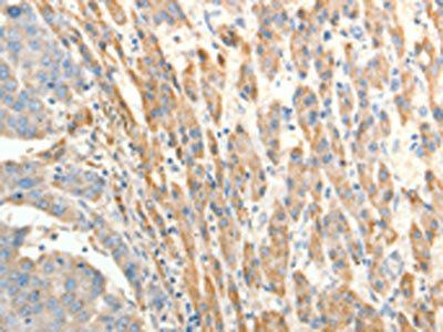 BIRC2 Antibody