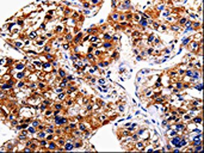 BIRC6 Antibody