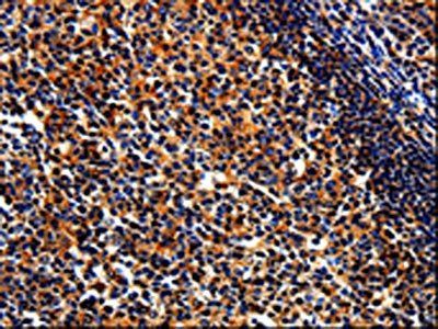 BIRC6 Antibody