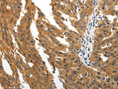 BIRC6 Antibody