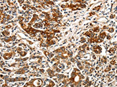 BIRC6 Antibody