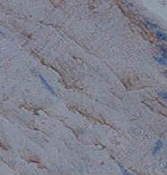 BMPR1A Rabbit Polyclonal Antibody