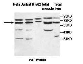 BMPR1A Rabbit Polyclonal Antibody