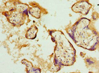 BNIP2 Antibody