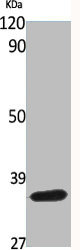 BNIP2 Antibody