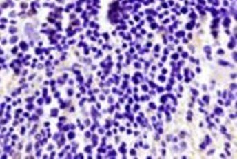 BOB1 Rabbit Polyclonal Antibody