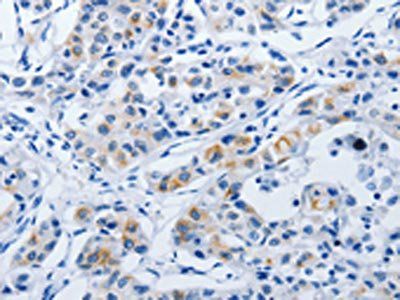 BPIFB3 Antibody