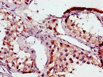 BRAF Antibody