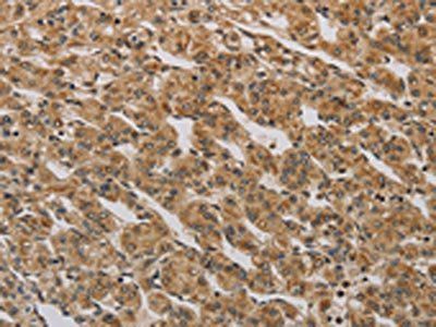 BRAF Antibody