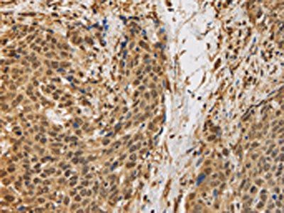 BRAF Antibody