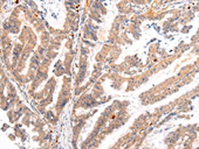 BSN Antibody