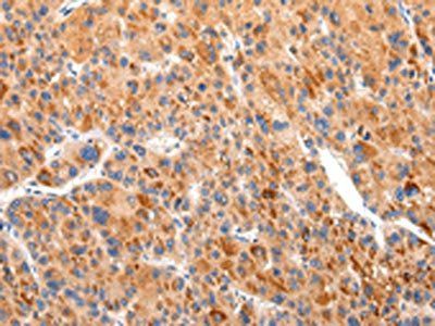 BSN Antibody