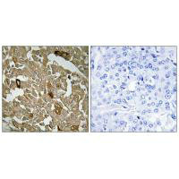 BTBD6 Antibody