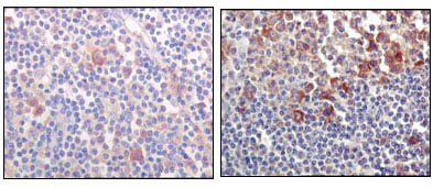 BTK Antibody