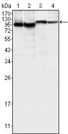 BTK Antibody