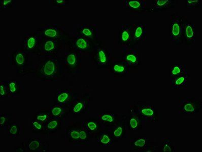 HIST1H2BC Antibody