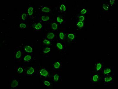 Butyrly-HIST1H3A (K18) Antibody