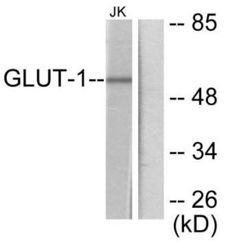 GLUT1 Antibody