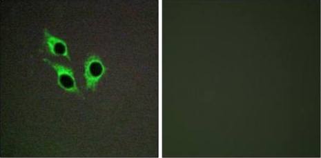 TM16J Antibody