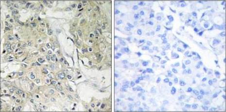 TM16J Antibody