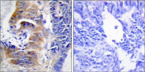 CDCA3 Antibody