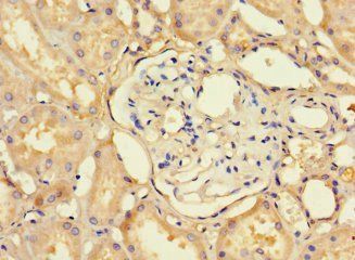 C12orf65 Antibody