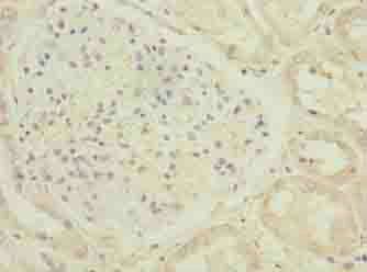 C17orf47 Antibody