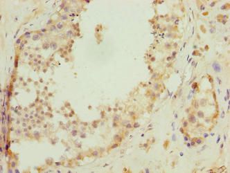 C17orf47 Antibody