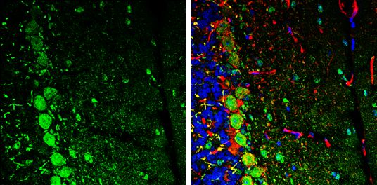 C17orf75 Rabbit Polyclonal Antibody