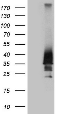 C19orf80 Antibody