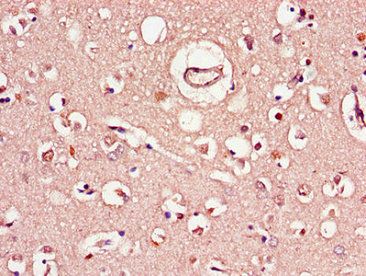C1QTNF9B Antibody