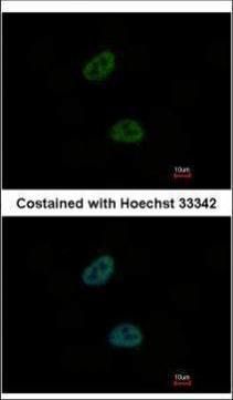 C20orf11 Rabbit Polyclonal Antibody