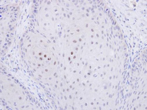 C20orf11 Rabbit Polyclonal Antibody