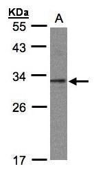 C20orf11 Rabbit Polyclonal Antibody
