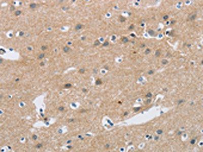 C2orf40 Antibody