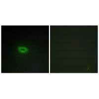 C2orf40 Antibody