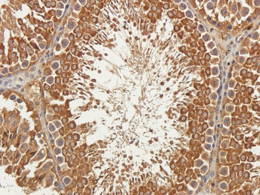 C4BPA Rabbit Polyclonal Antibody