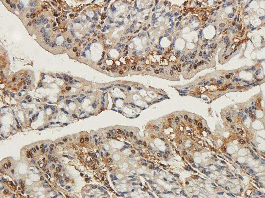 C4BPA Rabbit Polyclonal Antibody