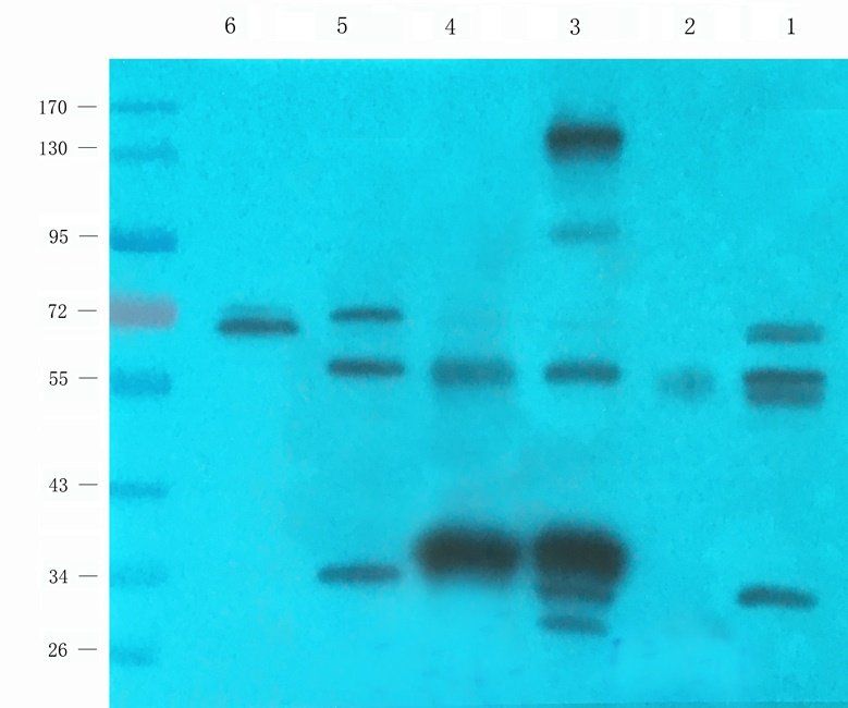 C4BPA Rabbit Polyclonal Antibody
